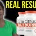 citrusburn